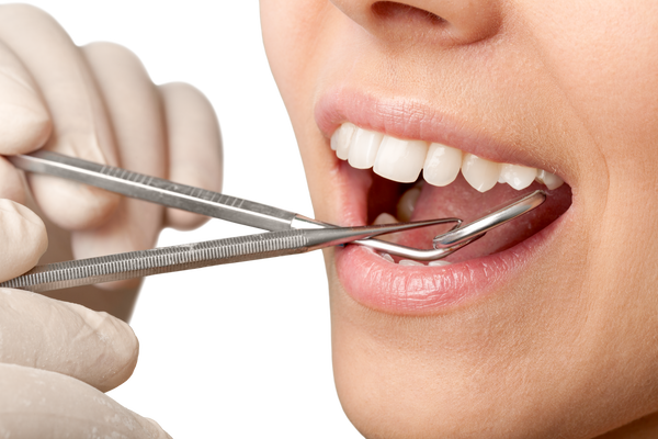 検診される歯のアップ